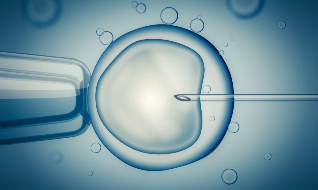 IVF invitro fertilisation
